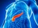 ASCO Issues Guidelines for Pancreatic Cancer Management