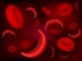 Novel Agent Reduces Pain Crises in Sickle Cell Anemia