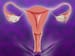 Commentary: Uterine Transplantation