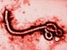 Ebola: What US Clinicians Need to Know