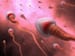 Father's Sperm Linked to Autism