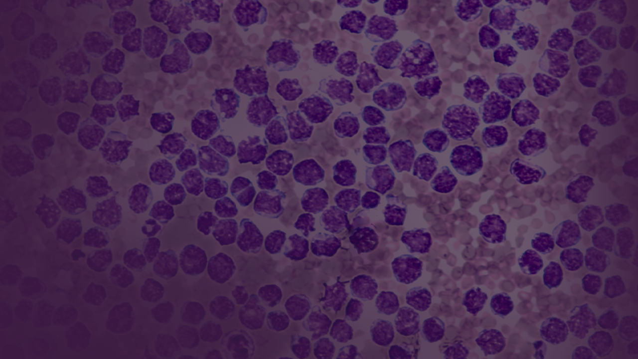 Clinical Advances With BCMA-Targeted Therapy in Multiple Myeloma