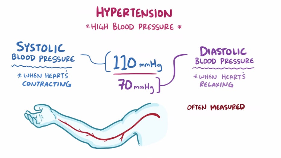 Hypertension: Overview Video
