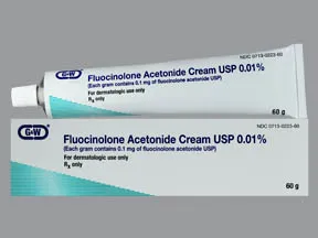 fluocinolone 0.01 % topical cream