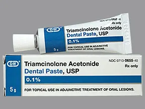 triamcinolone acetonide 0.1 % dental paste