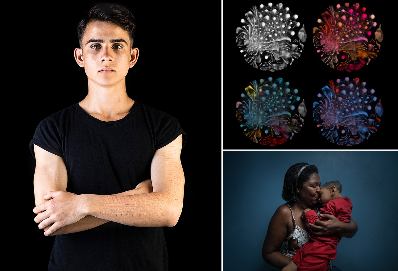 Prize Photos Reveal Medicine's Humanity