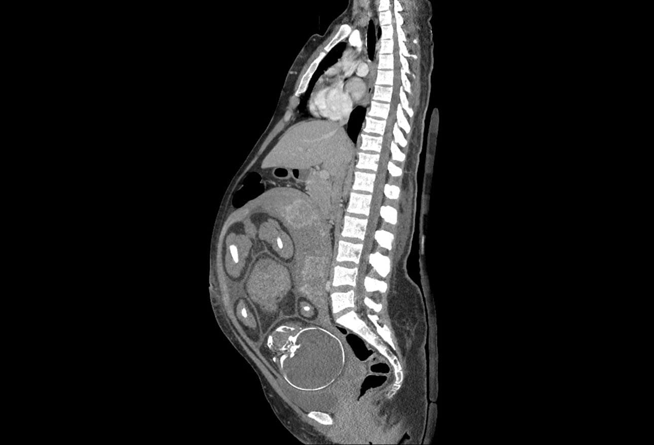 Baby Belly Aches 7 Causes of Abdominal Pain in Pregnancy