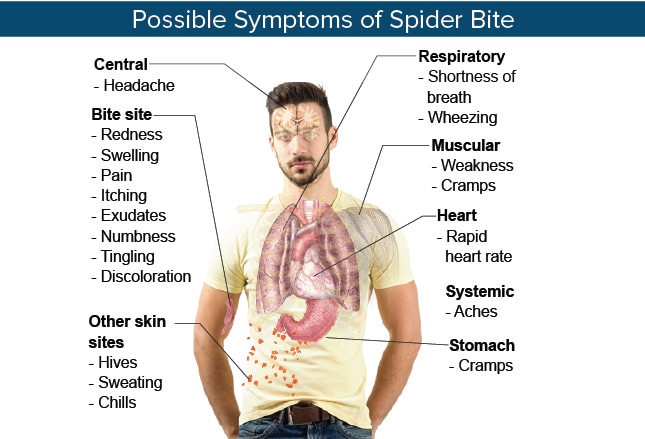 5 Arthropod Envenomations: From Benign Bites to Serious Stings