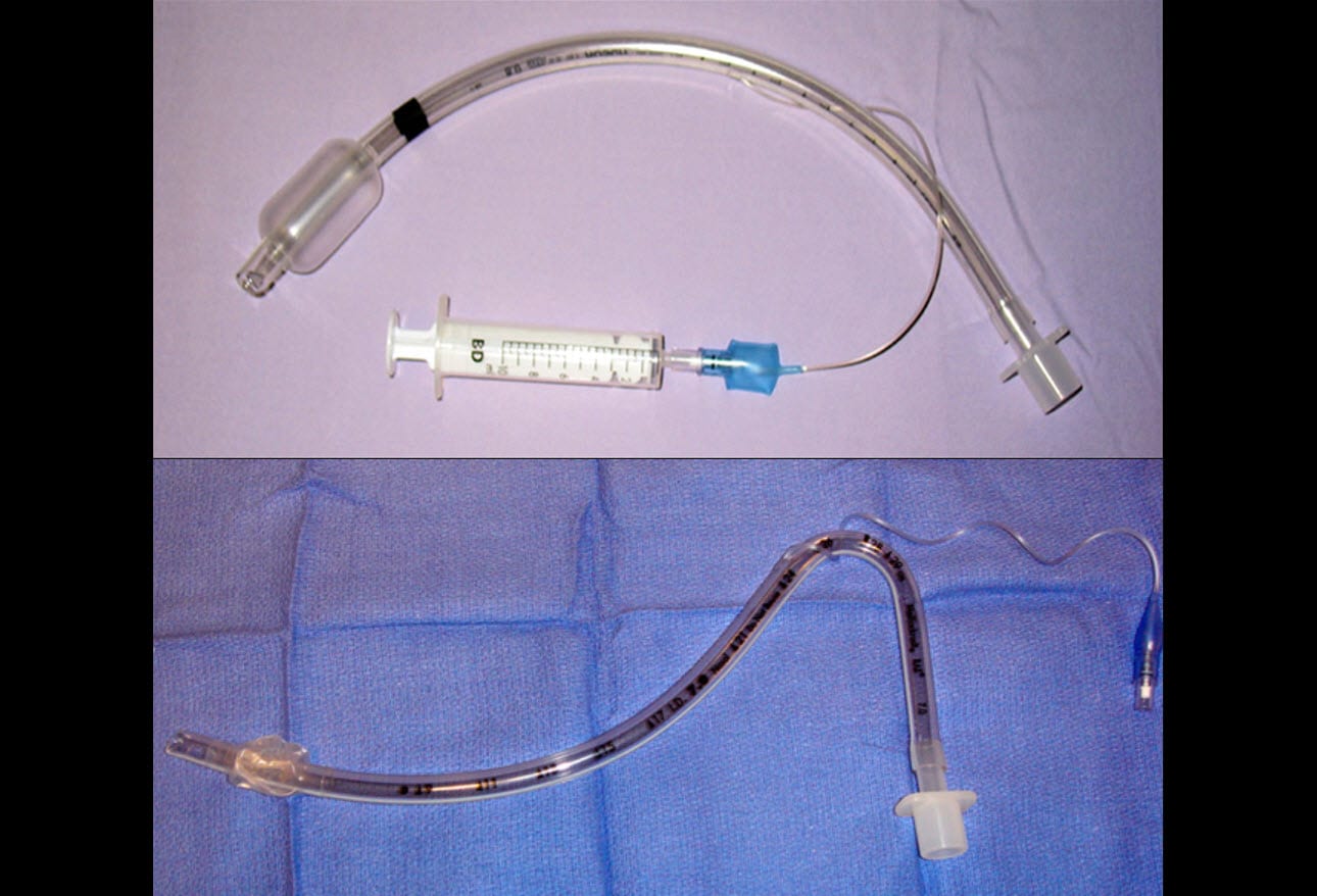 Awake Fiberoptic Intubation: Accessing the Airway