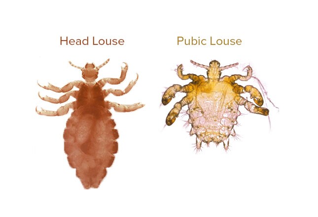 When Bugs Feast: What’s Causing That Itch?