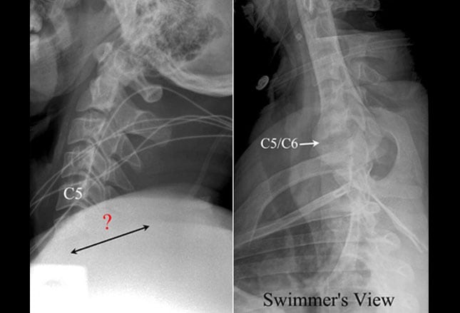 swimmers view x ray