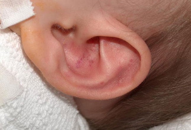 Recognizing Physical Child Abuse