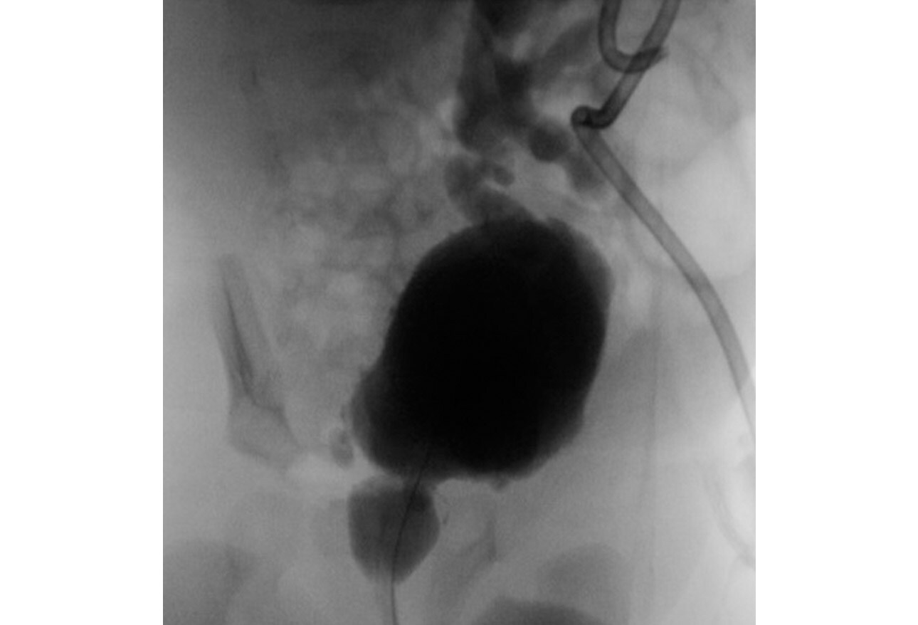 Congenital Anomalies Of The Genitourinary System