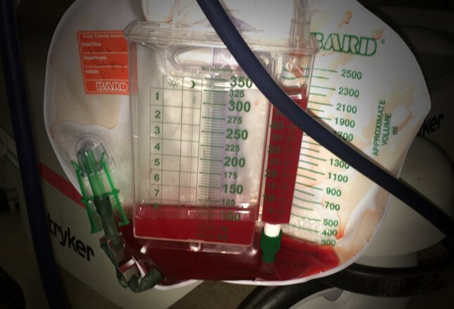 Florinef for low blood pressure zone