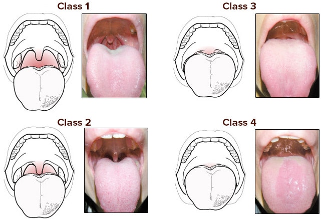 Slide 11