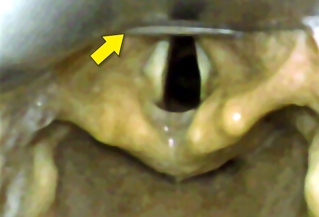 Slide 9