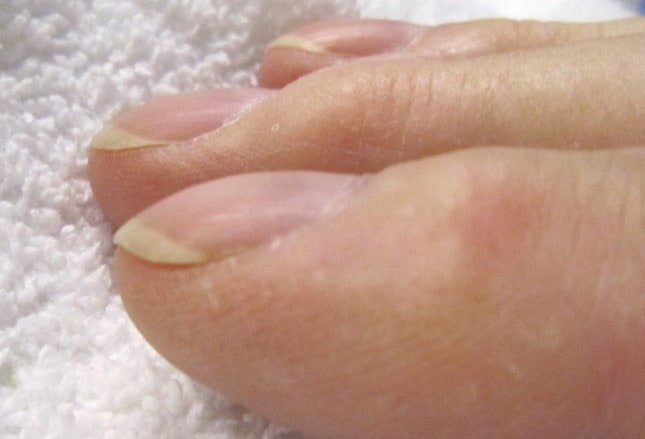 nail skin