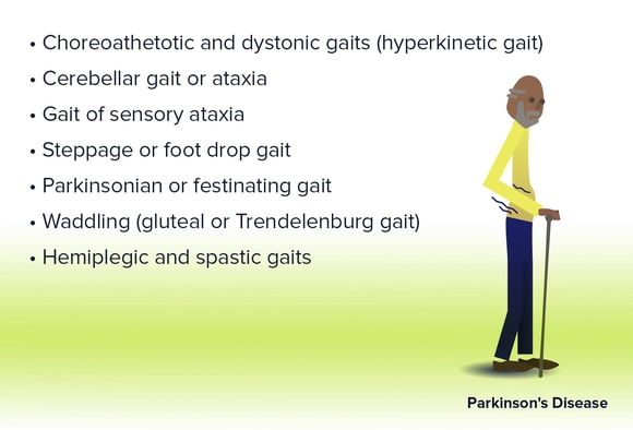Abnormal Gait Abnormal Gait Syndromes In General Gait