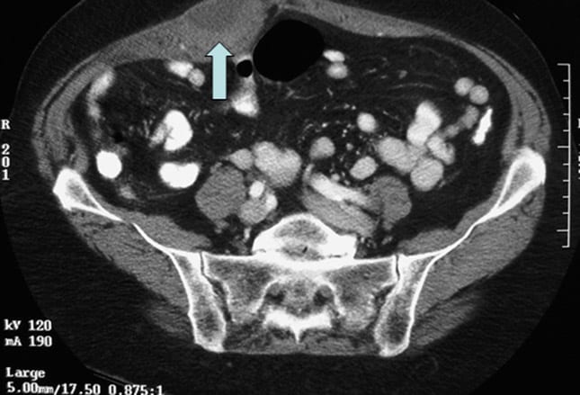 Can't-Miss Gastrointestinal Diagnoses