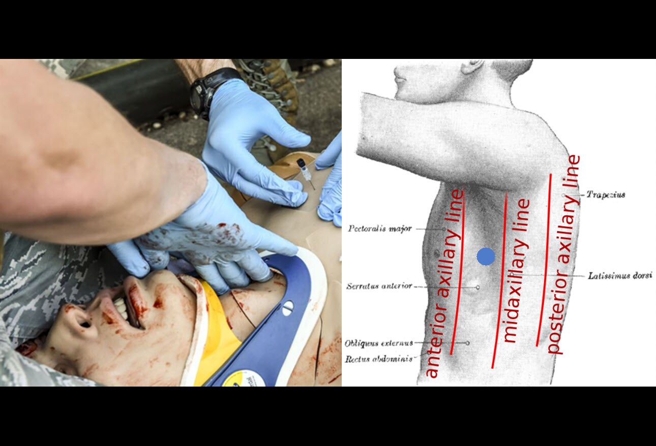 Gunshot Wounds: A Targeted Approach