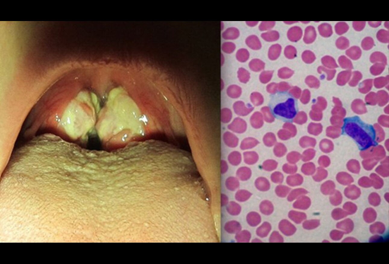 Herpesviruses Test Your Knowledge