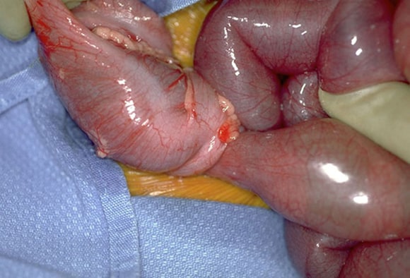 11 Abdominal Emergencies Infants