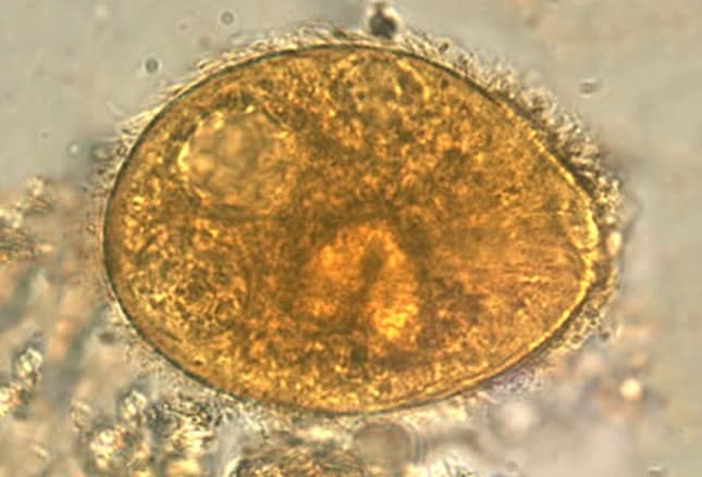What's Eating You: 12 Common Intestinal Parasites