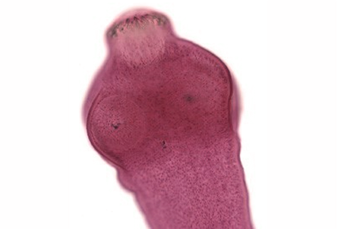 What's Eating You: 12 Common Intestinal Parasites