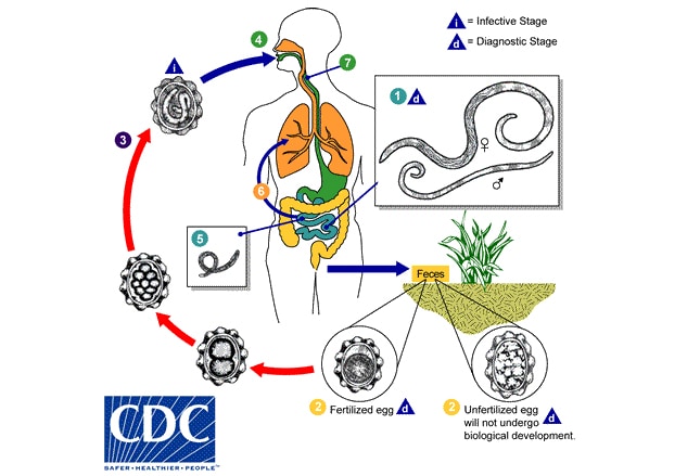 What's Eating You: 12 Common Intestinal Parasites