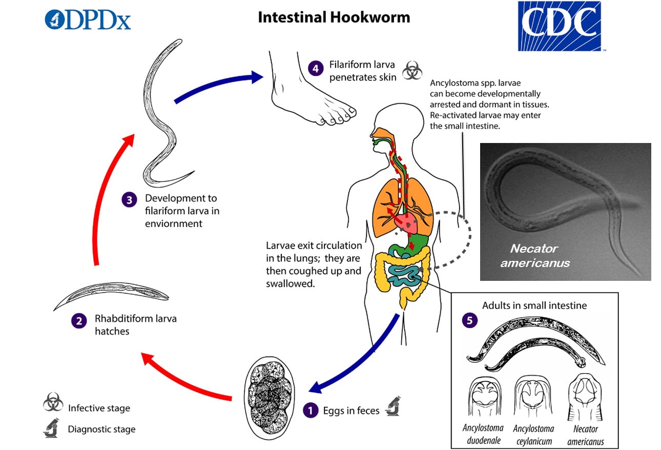 What S Eating You 12 Common Intestinal Parasites