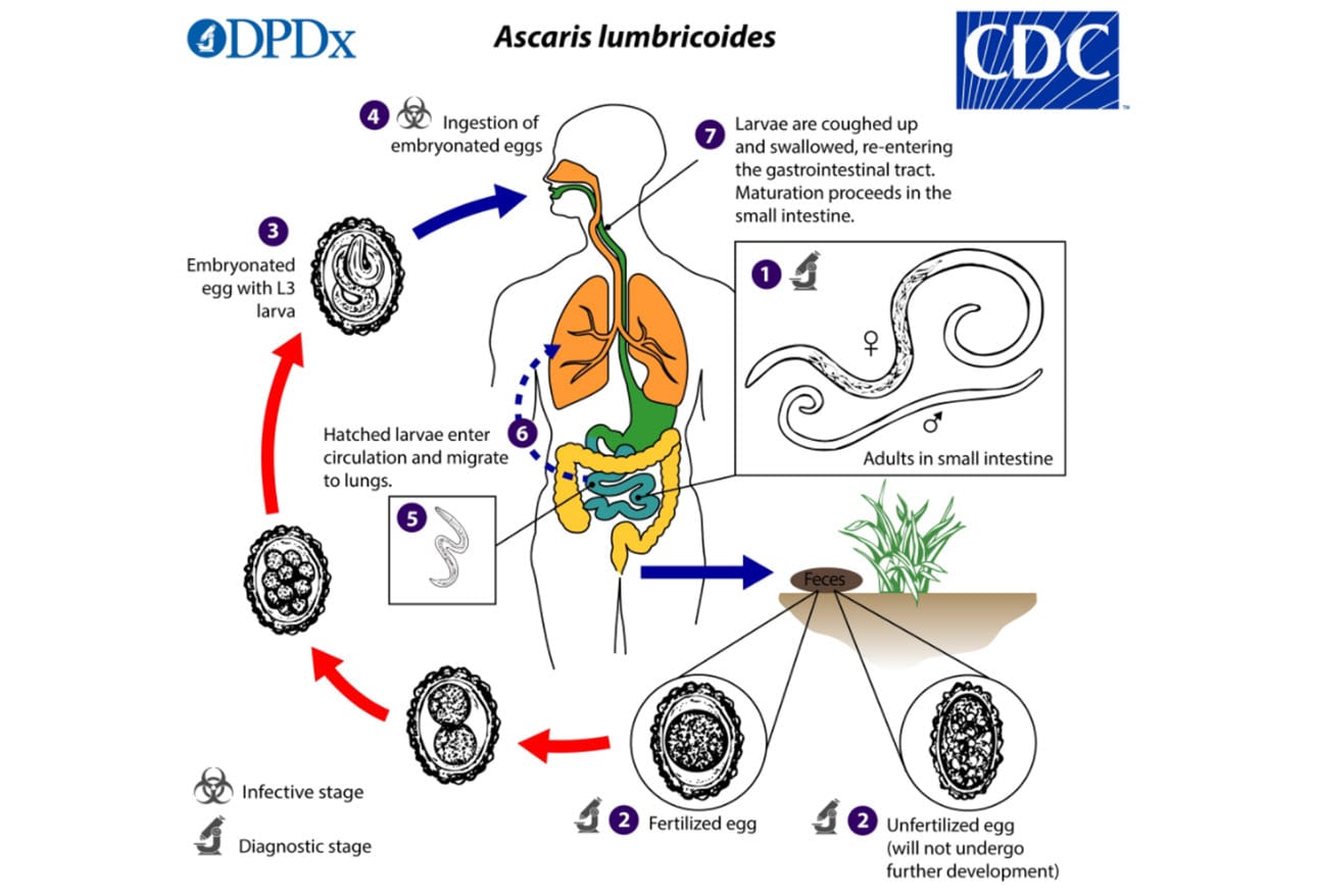 You've Got Worms! Common Intestinal Parasites