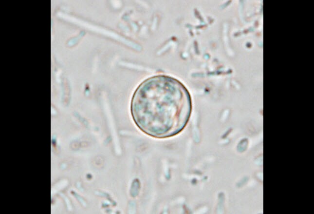 Your Unwanted Internal Pets: Intestinal Parasites (Other Than Nematodes)