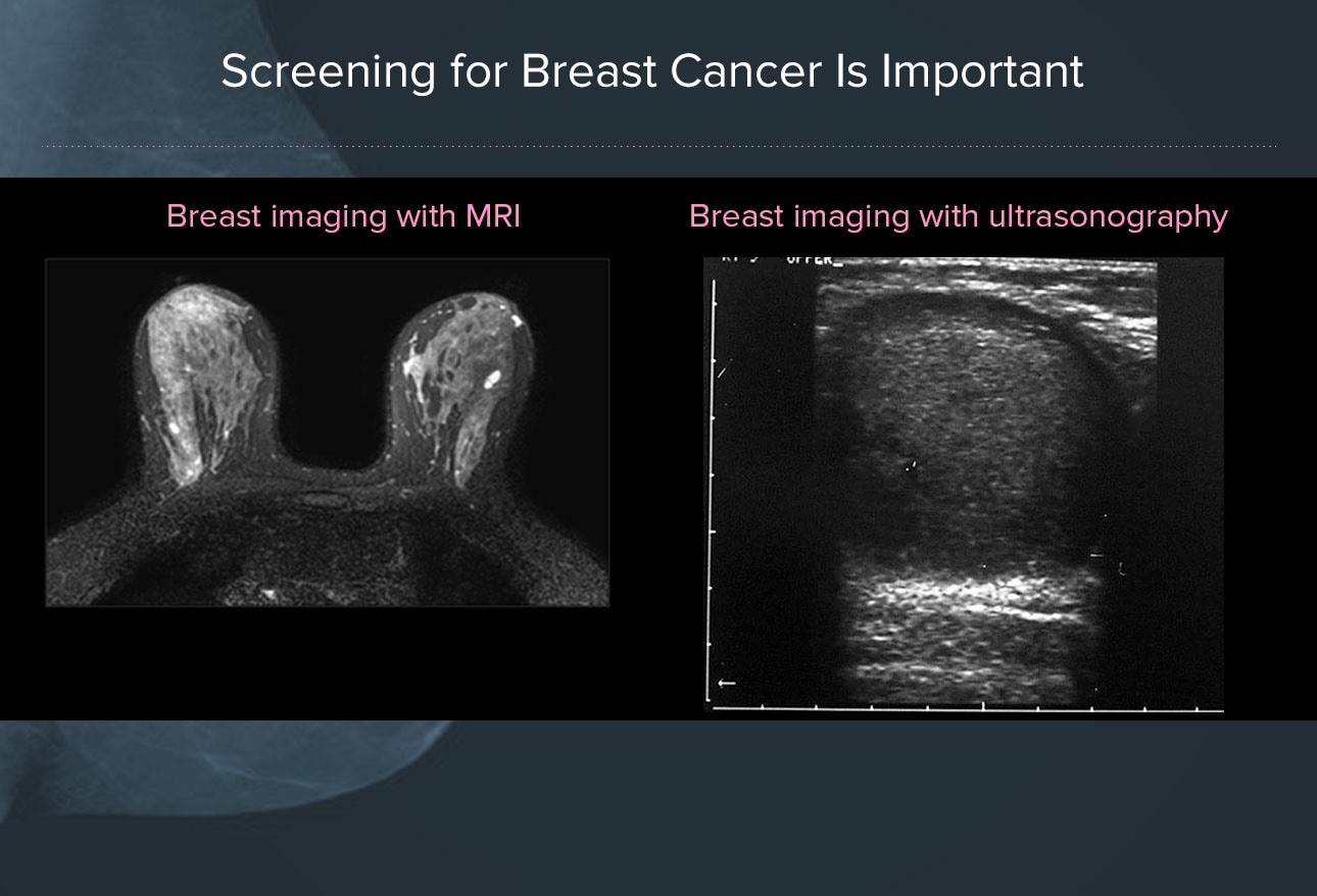 Mammogram Screening Guidelines 2024 Cpt - Fancie Lucila