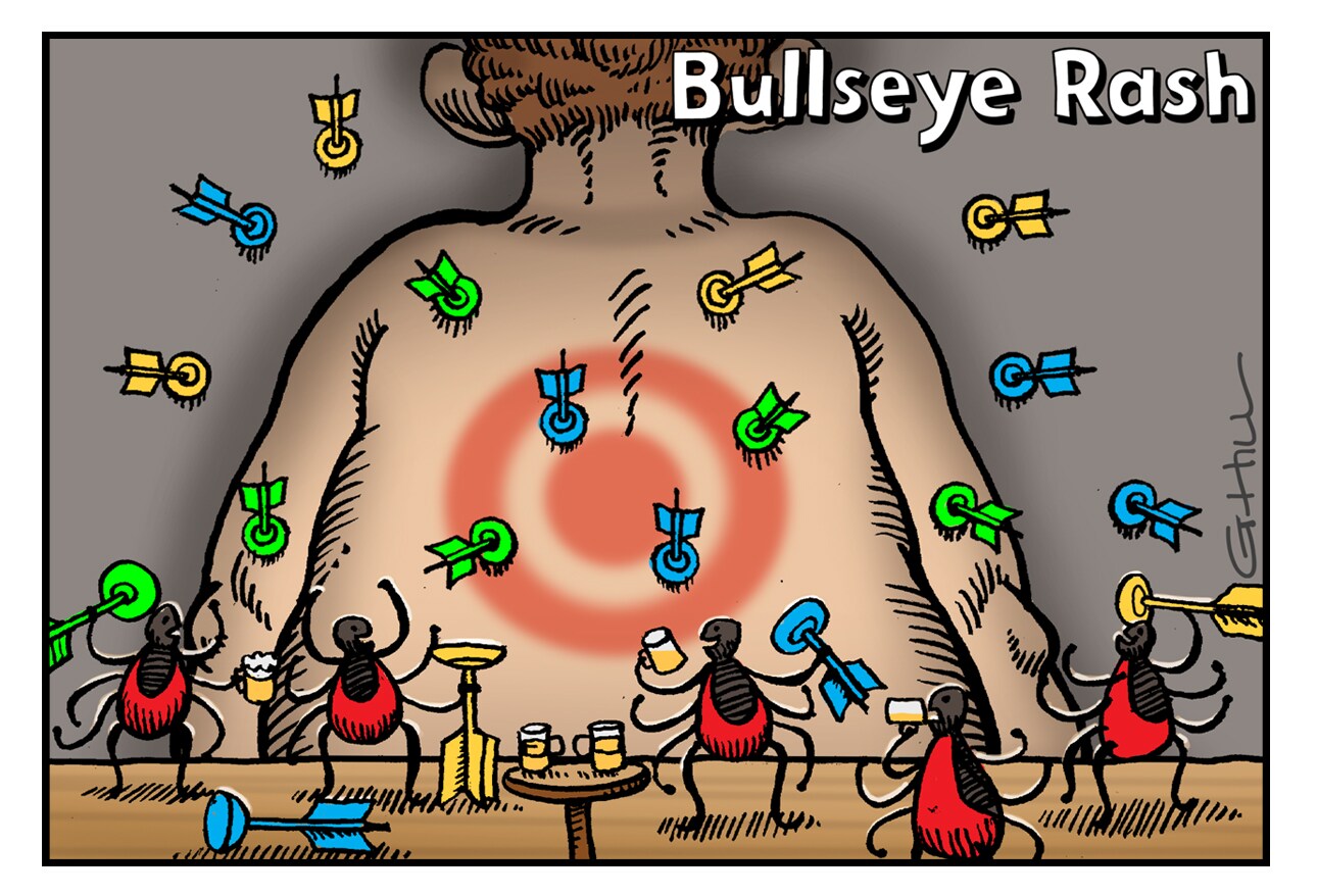 Candy Cane Esophagus, Glue Ear, and More Colorful Medical 'Metaphors'