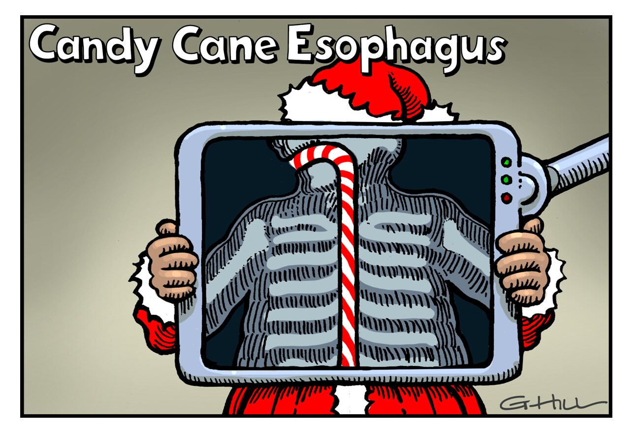 Candy Cane Esophagus, Glue Ear, and More Colorful Medical 'Metaphors'