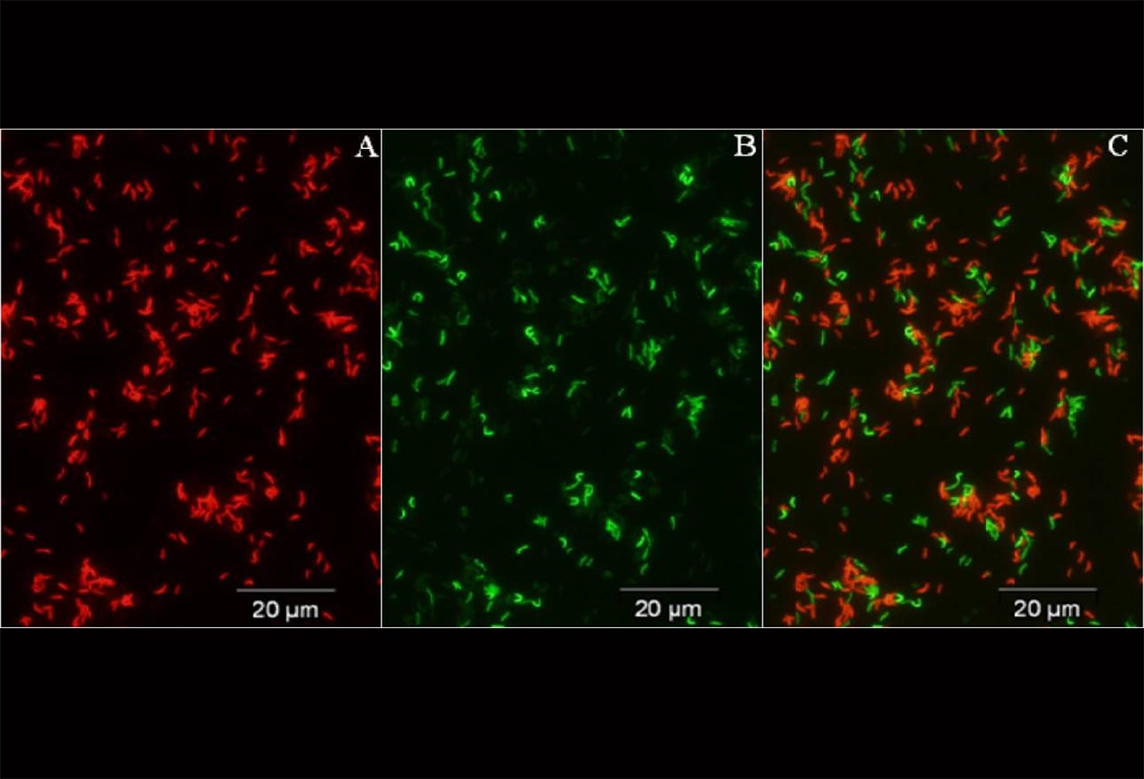 Multidrug Resistant Organisms (MDROs) Growing, Spreading, and Killing