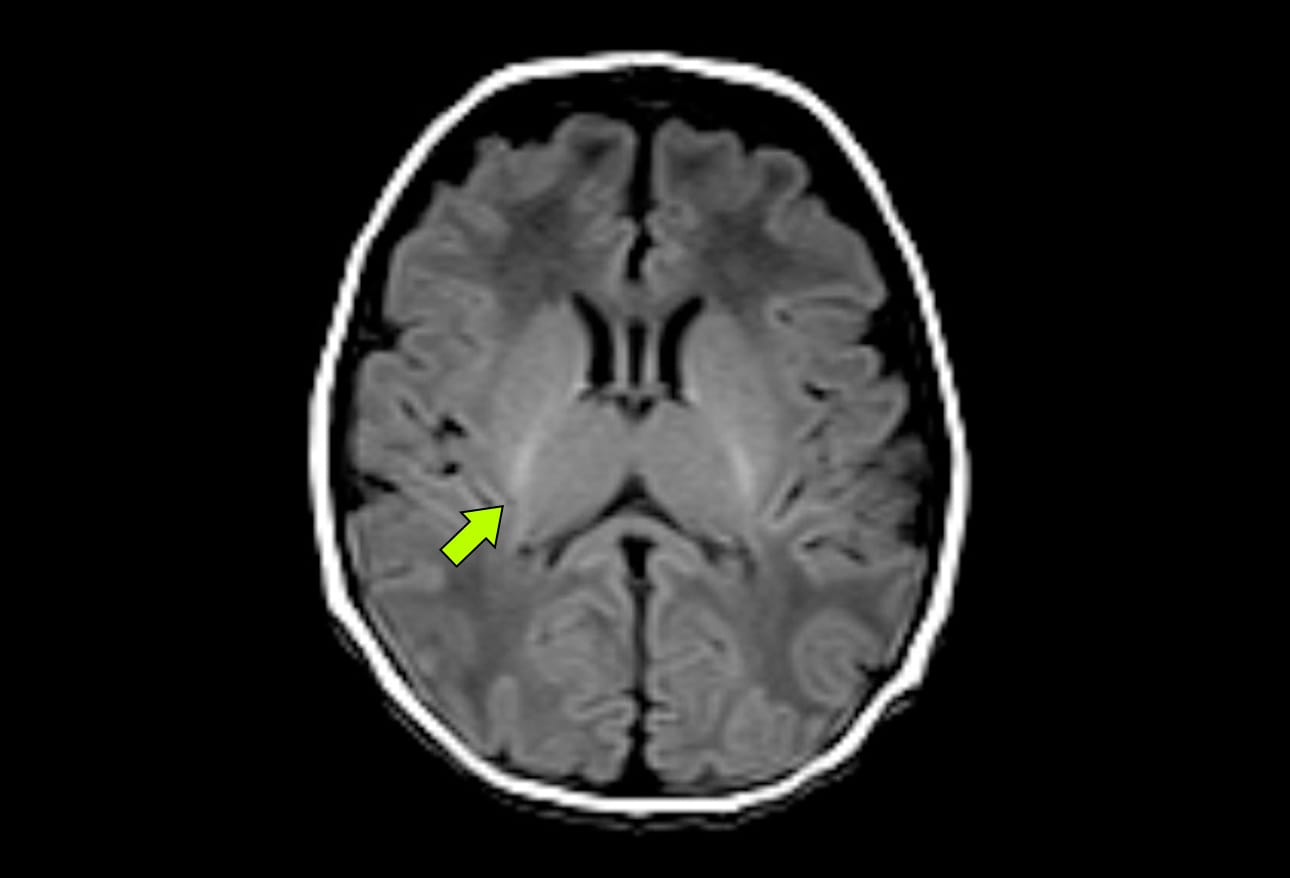 Neonatal Brain Anatomy Diagrams