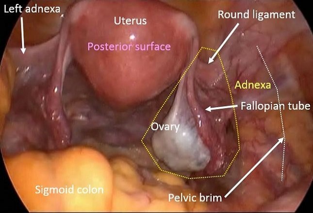 Ovarian Cysts Functional Or Neoplastic Benign Or Malignant Ovarian Cysts Functional Or Neoplastic Benign Or Malignant