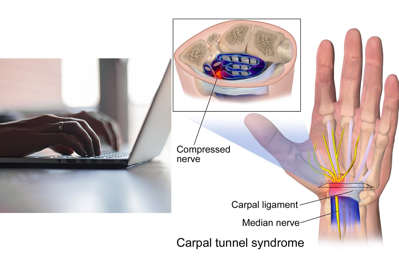 4 Technology Overuse Injuries You Should Know
