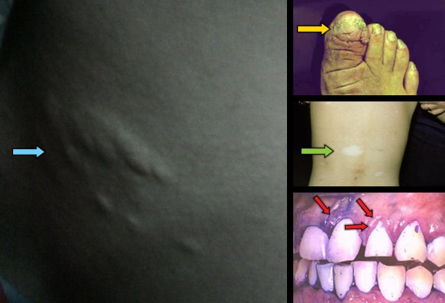 Slide 11