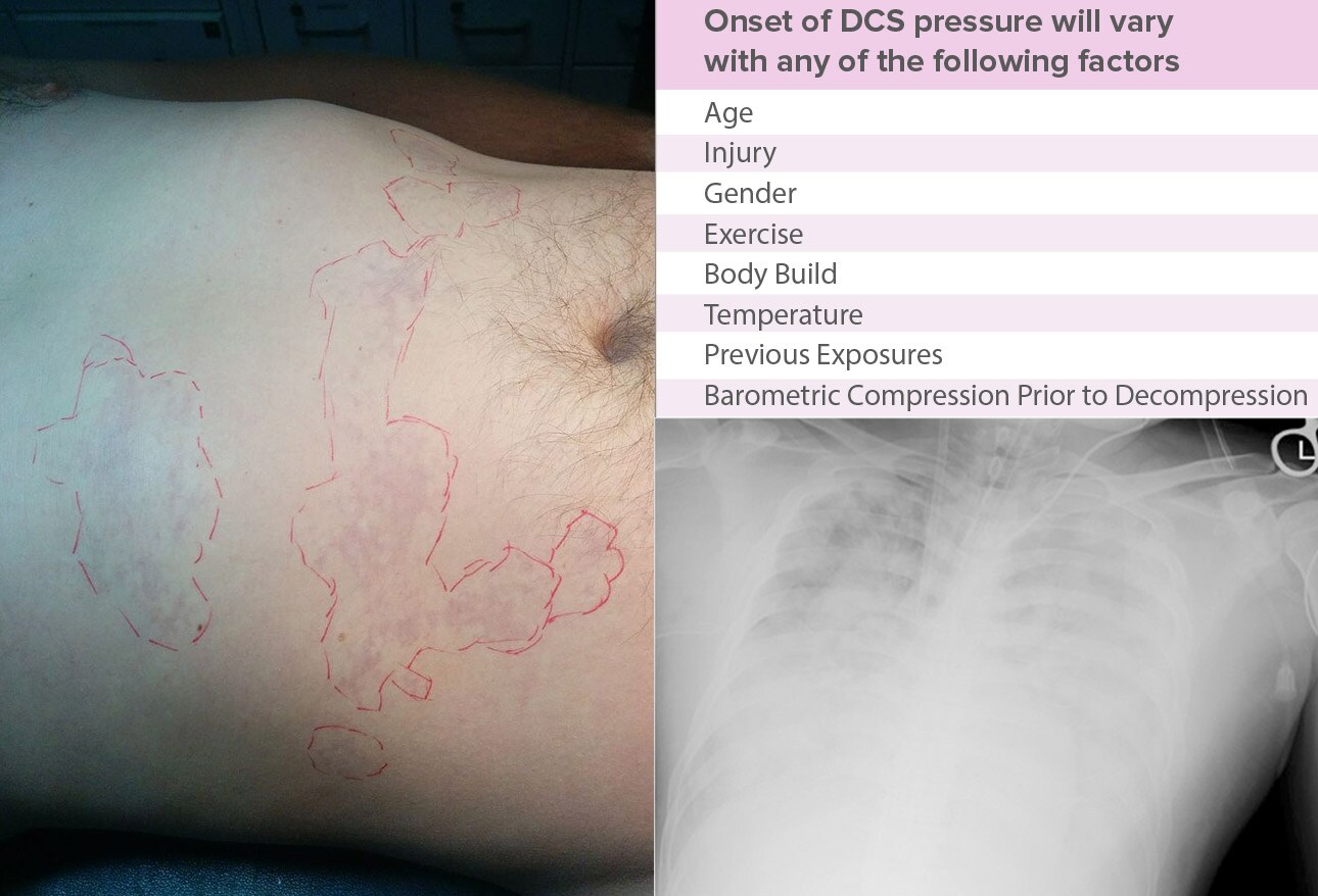 Scuba Diving Injuries and Underwater Hazards