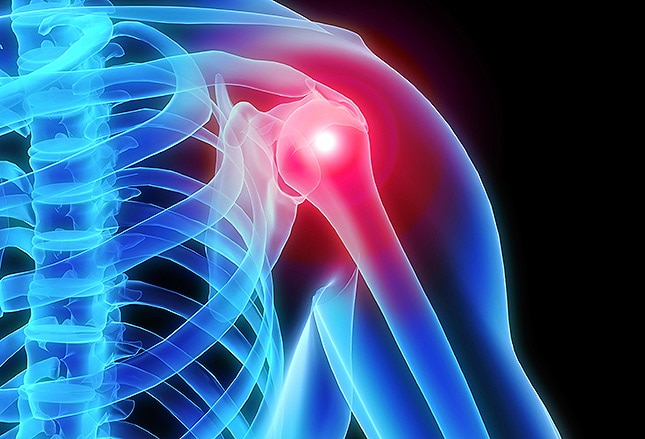 Rotator Cuff Injury & Shoulder Injuries - Sterling Medical Group