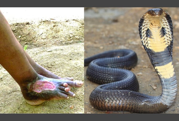 indian cobra snake attack