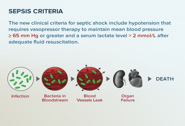 Slide 9