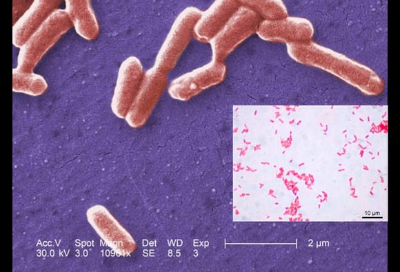 Urinary Tract Infections A Spectrum Of Pathologies And Challenges