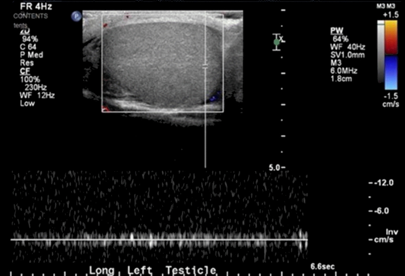 12 Urologic Emergencies You Need To Know