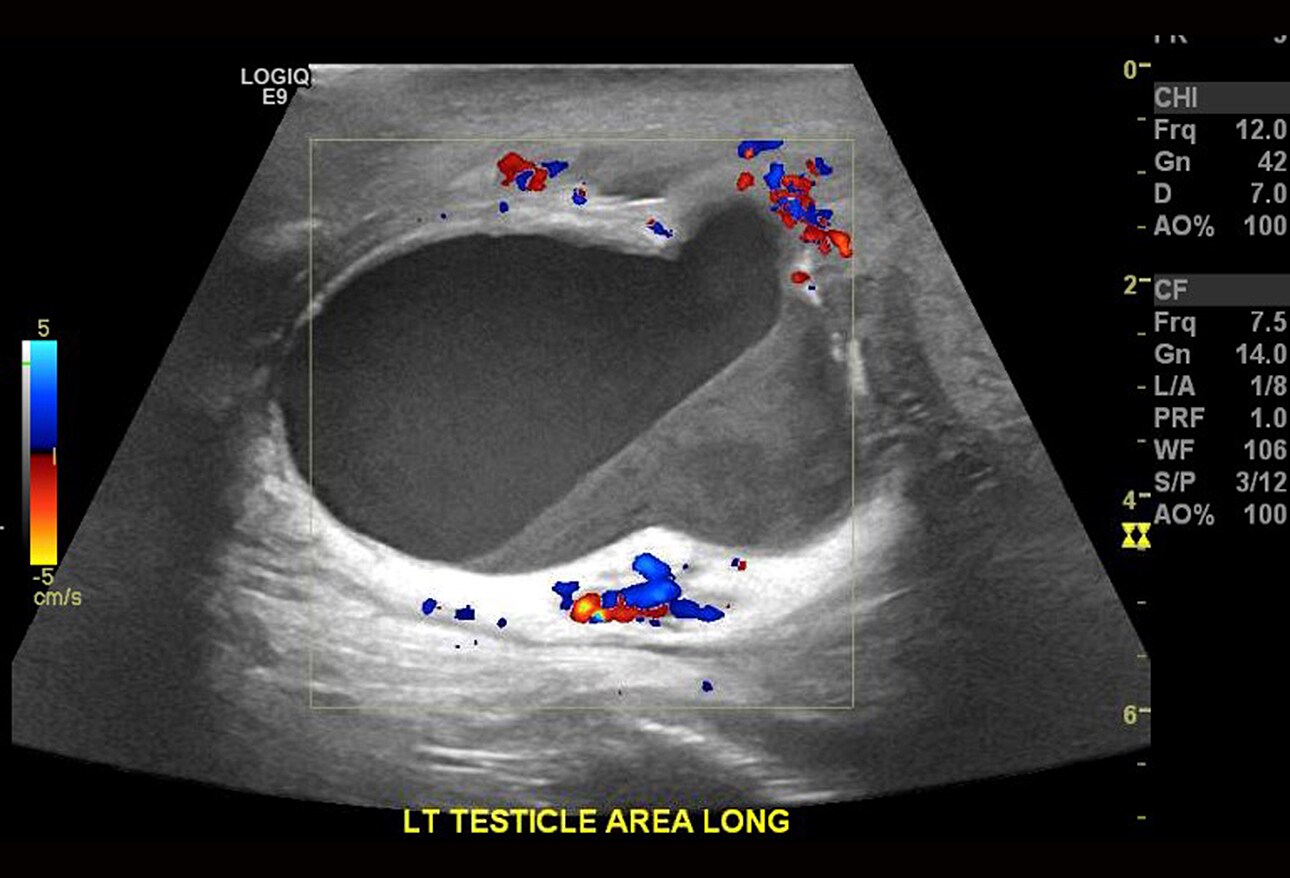 12 Urologic Emergencies You Need To Know