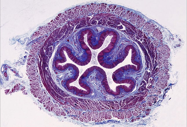 Slide 28