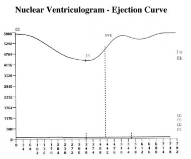 Left ventricular time-activity curve, with end dia