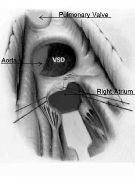 a) Preoperative findings. A 41-year-old woman with an elastic, hard